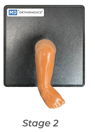 Modèle Mitchell Ponseti® de pied bot stade 2 en caoutchouc pour formation au moulage - DROIT