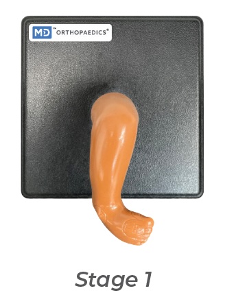 [MD-MOD-STAG1-RW] Modèle Mitchell Ponseti® de pied bot stade 1 en caoutchouc pour formation au moulage - DROIT